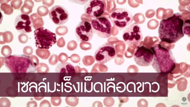 แกงไทย ต้านมะเร็ง ได้จริง?