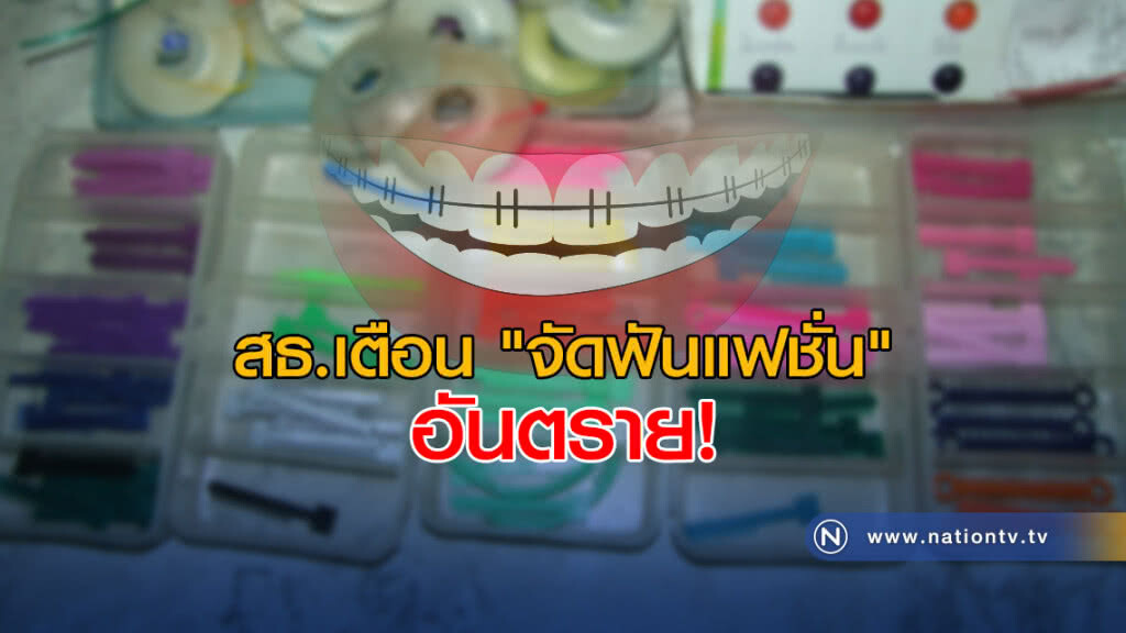 สธ.เตือน "จัดฟันแฟชั่น" อันตราย! ฟันล้ม เหงือกอักเสบ ติดเชื้อ