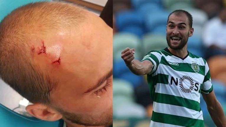 เกินเหตุ!แฟนลิสบอนบุกทำร้ายนักเตะทีมตัวเองถึงสนามซ้อม