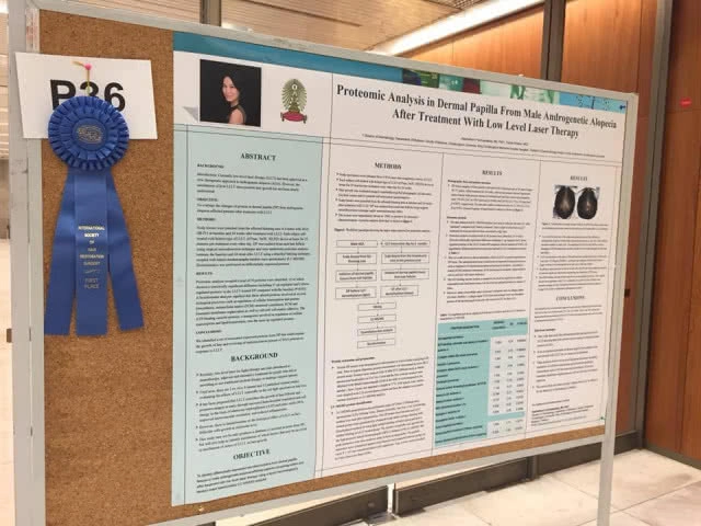 ผมร่วงจากพันธุกรรม รักษาได้ด้วยแสงเลเซอร์ความเข้มข้นต่ำ