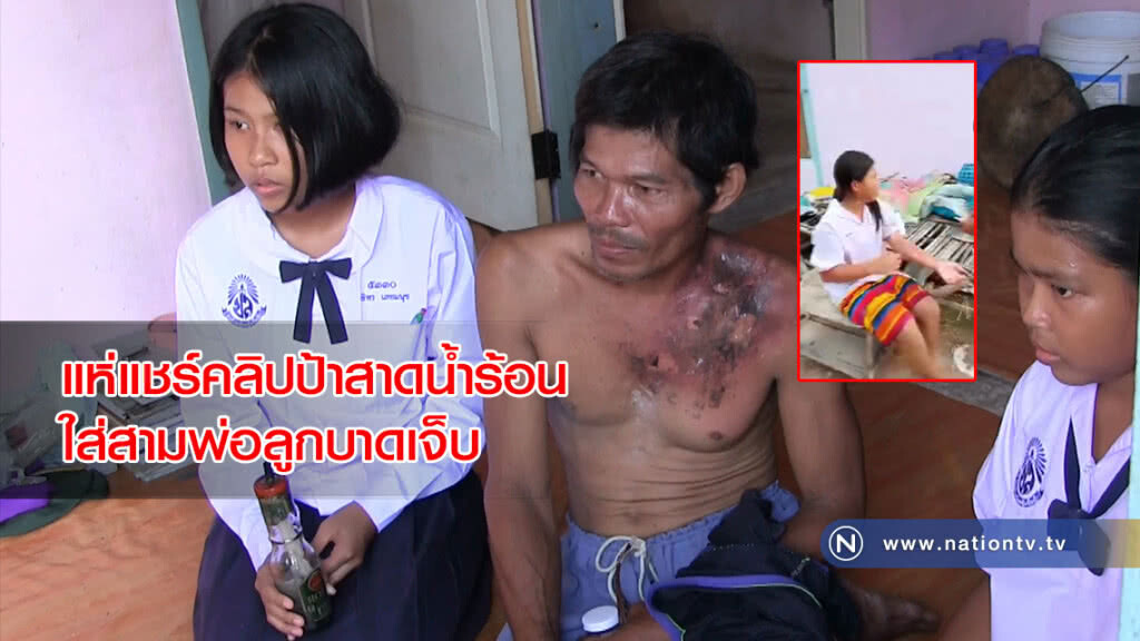 แห่แชร์คลิปป้าสาดน้ำร้อนใส่สามพ่อลูกบาดเจ็บหลายหน่วยงานรุดช่วย