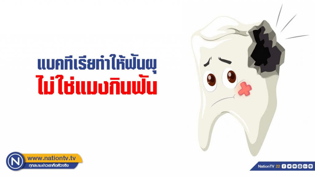 แบคทีเรียทำให้ฟันผุ ไม่ใช่แมงกินฟัน แบคทีเรียทำให้ฟันผุ ไม่ใช่แมงกินฟัน