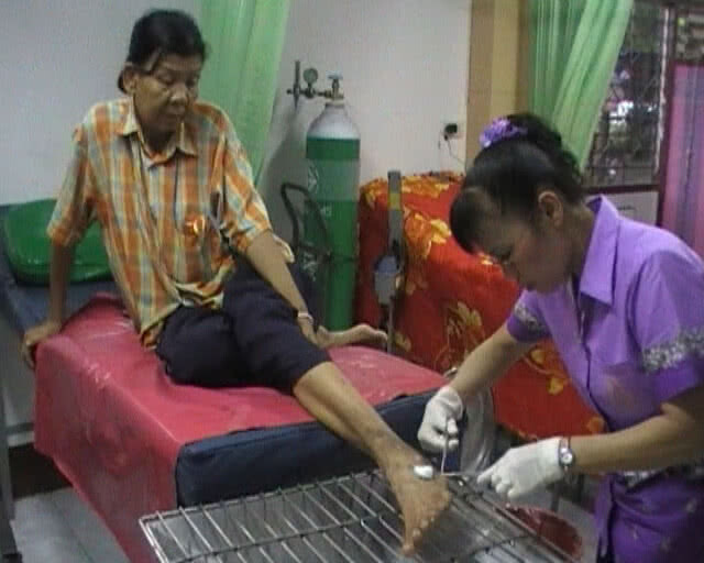 โอน รพ.ส่งเสริมสุขภาพตำบล พ้นจาก สธ. ให้ท้องถิ่นดูแล