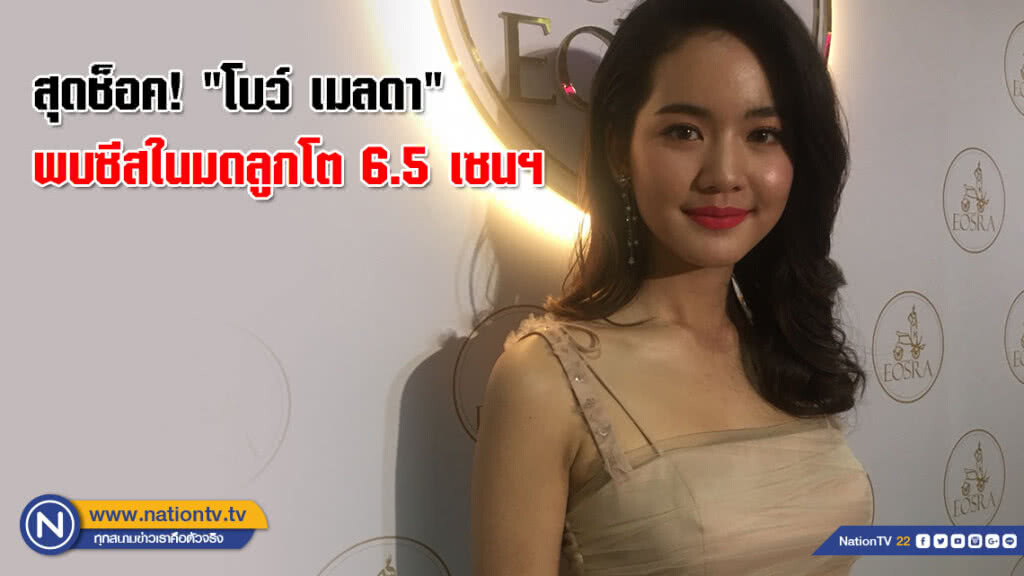 สุดช็อค! "โบว์ เมลดา" ตรวจพบซีสในมดลูกโต 6.5 เซนฯ สุดช็อค! "โบว์ เมลดา" ตรวจพบซีสในมดลูกโต 6.5 เซนฯ