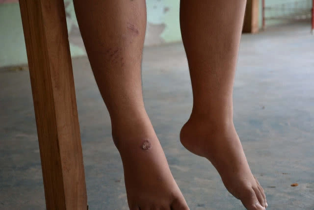 ระทึก! ตู้เอทีเอ็ม ช็อตเด็กกดเงิน หวิดดับโชคดี เพื่อนดึงออกจากตู้ทัน