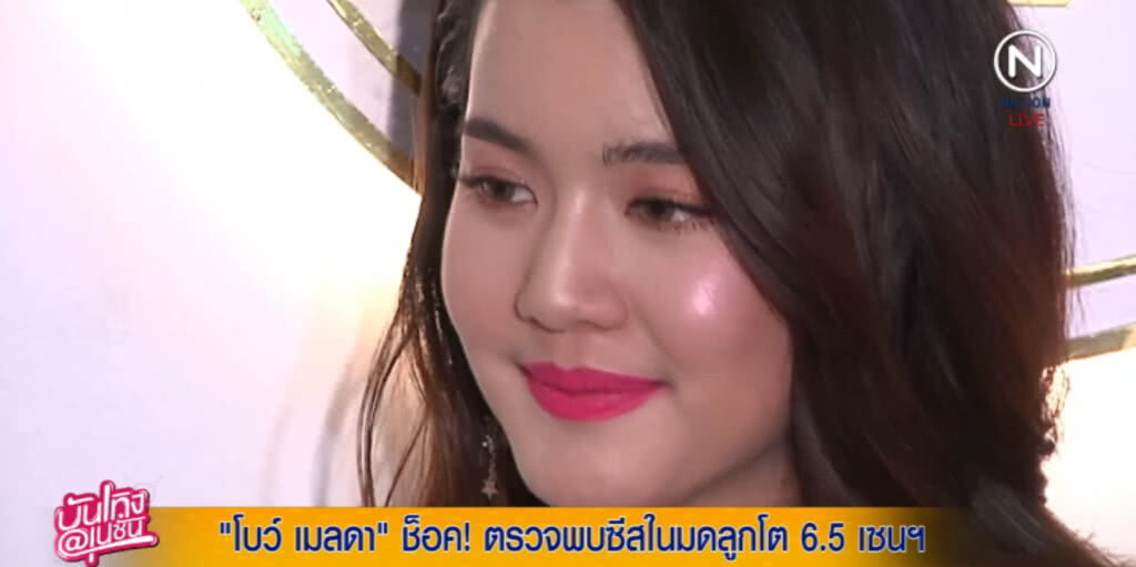 ช็อค!...."โบว์ เมลดา" พบซีสในมดลูก 6.5 ซ.ม.เตรียมเคลียร์คิวผ่าตัด ช็อค!...."โบว์ เมลดา" พบซีสในมดลูก 6.5 ซ.ม.เตรียมเคลียร์คิวผ่าตัด