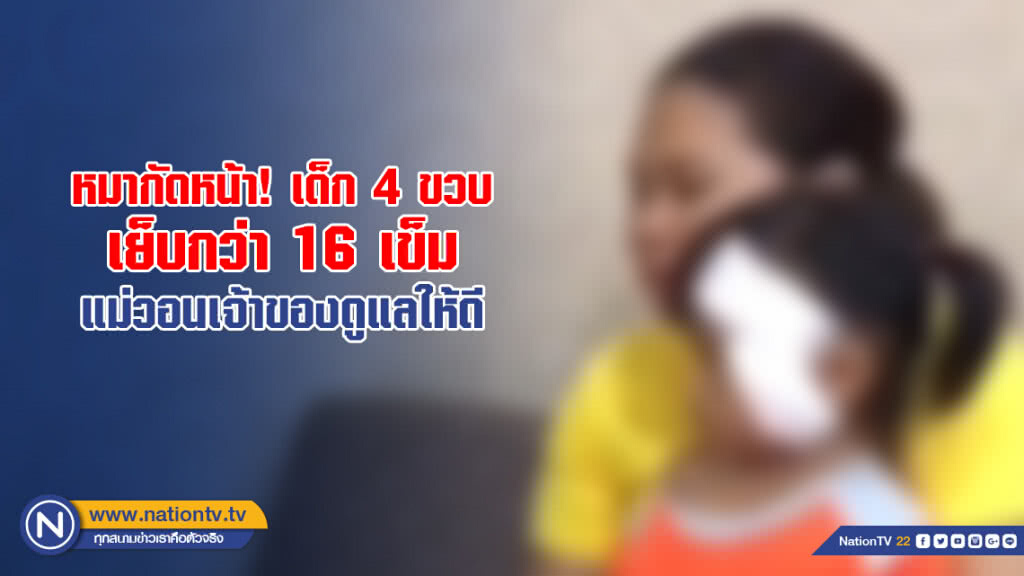 หมากัดหน้า! เด็ก 4 ขวบ เย็บกว่า 16 เข็ม แม่เหยื่อวอนเจ้าของดูแลสัตว์เลี้ยงให้ดี