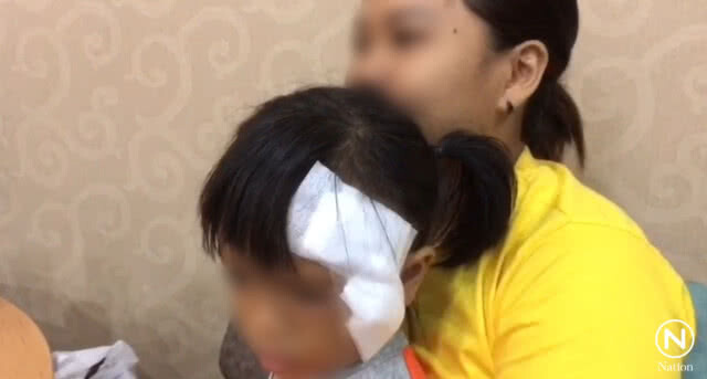 หมากัดหน้า! เด็ก 4 ขวบ เย็บกว่า 16 เข็ม แม่เหยื่อวอนเจ้าของดูแลสัตว์เลี้ยงให้ดี