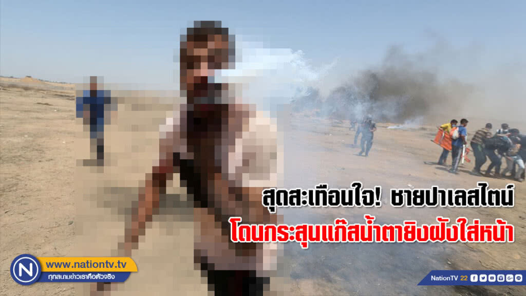 สุดสะเทือนใจ! ชายปาเลสไตน์โดนกระสุนแก๊สน้ำตายิงฝังใส่หน้า (คลิปรุนแรง) สุดสะเทือนใจ! ชายปาเลสไตน์โดนกระสุนแก๊สน้ำตายิงฝังใส่หน้า (คลิปรุนแรง)