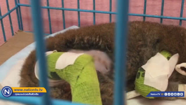 'ตัดขาทิ้ง' ช่วยชีวิตนางอาย ถูกไฟช็อต ล่าสุด 'ยังโคม่า'