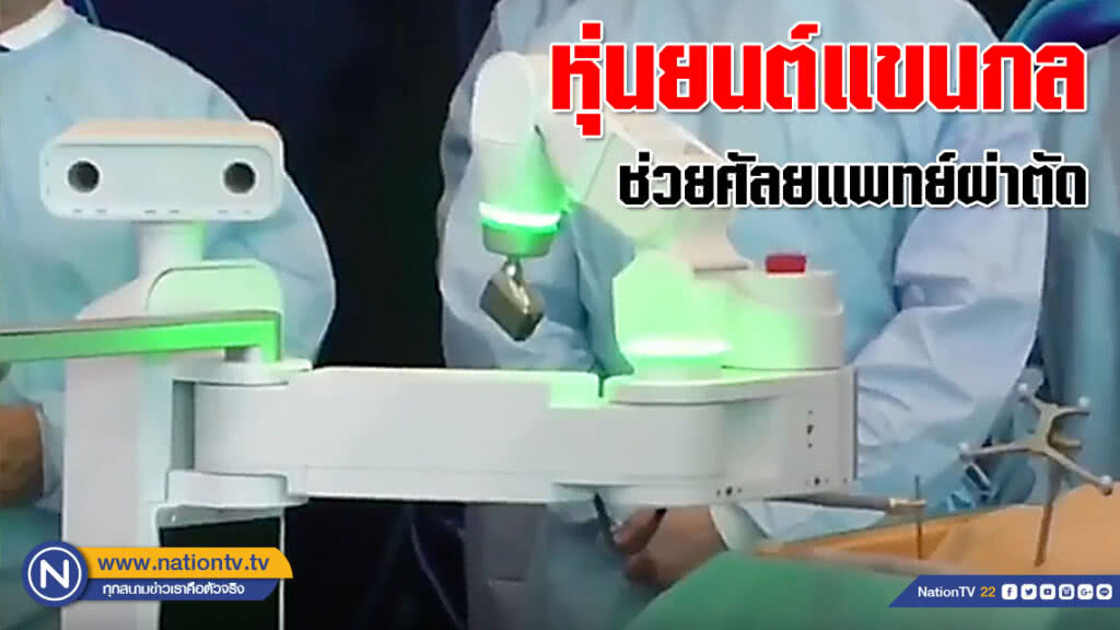 หุ่นยนต์แขนกลช่วยศัลยแพทย์ผ่าตัด (คลิป) หุ่นยนต์แขนกลช่วยศัลยแพทย์ผ่าตัด (คลิป)