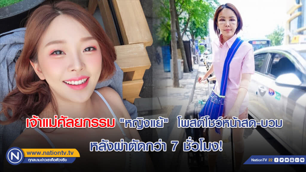 เจ้าแม่ศัลยกรรม "หญิงแย้" โพสต์โชว์หน้าสด-บวม หลังผ่าตัดกว่า 7 ชั่วโมง! เจ้าแม่ศัลยกรรม "หญิงแย้" โพสต์โชว์หน้าสด-บวม หลังผ่าตัดกว่า 7 ชั่วโมง!