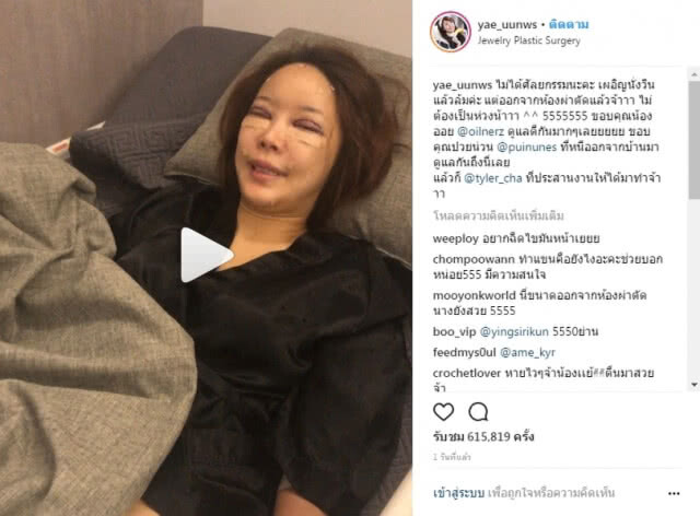 เจ้าแม่ศัลยกรรม "หญิงแย้"  โพสต์โชว์หน้าสด-บวม หลังผ่าตัดกว่า 7 ชั่วโมง!