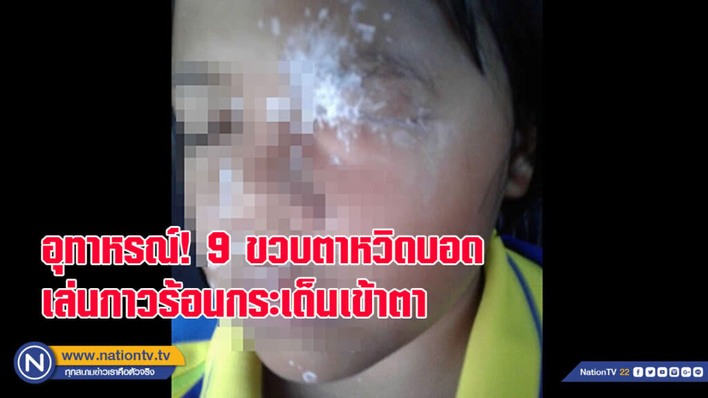 อุทาหรณ์ ด.ญ.9 ขวบตาหวิดบอด เล่นกาวร้อนกระเด็นเข้าตา