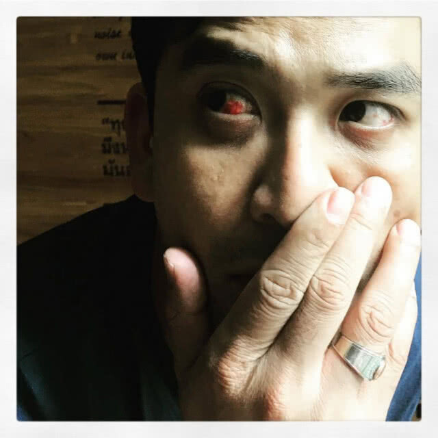 'ป๋อ' แจงเหตุโพสต์ภาพ 'เลือดในตาแตก' 