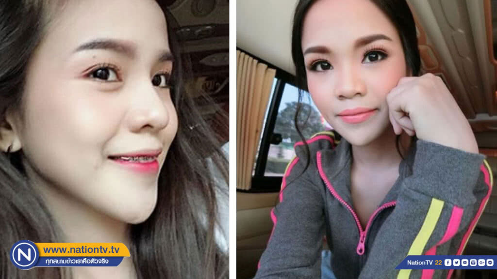"อาม-ชุติมา" เคลียร์ชัด!! ประเด็นศัลยกรรมคาง