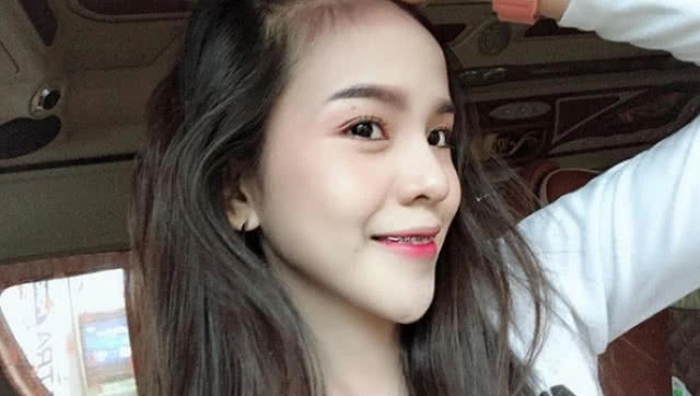 "อาม-ชุติมา" เคลียร์ชัด!! ประเด็นศัลยกรรมคาง