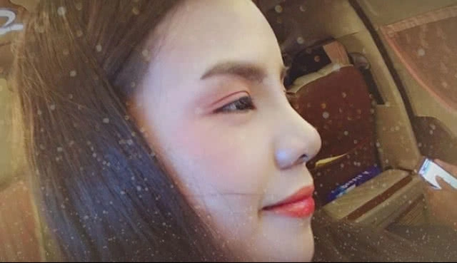 "อาม-ชุติมา" เคลียร์ชัด!! ประเด็นศัลยกรรมคาง