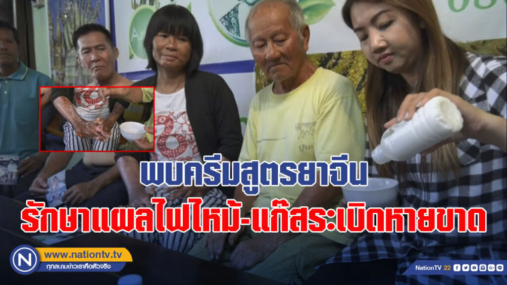 พบครีมสูตรยาจีนของอาม่า รักษาแผลไฟไหม้ แก๊สระเบิดหายขาด
