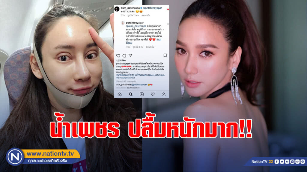 น้ำเพชร ปลื้มหนักมาก "แม่อั้ม" มาเม้นต์ หลังศัลยกรรมหน้า น้ำเพชร ปลื้มหนักมาก "แม่อั้ม" มาเม้นต์ หลังศัลยกรรมหน้า