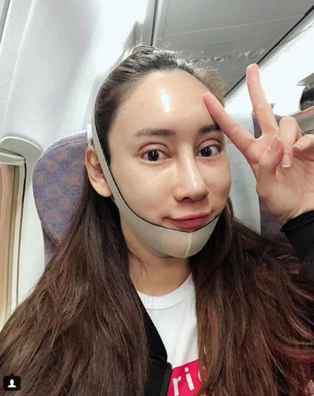 น้ำเพชร ปลื้มหนักมาก "แม่อั้ม" มาเม้นต์ หลังศัลยกรรมหน้า