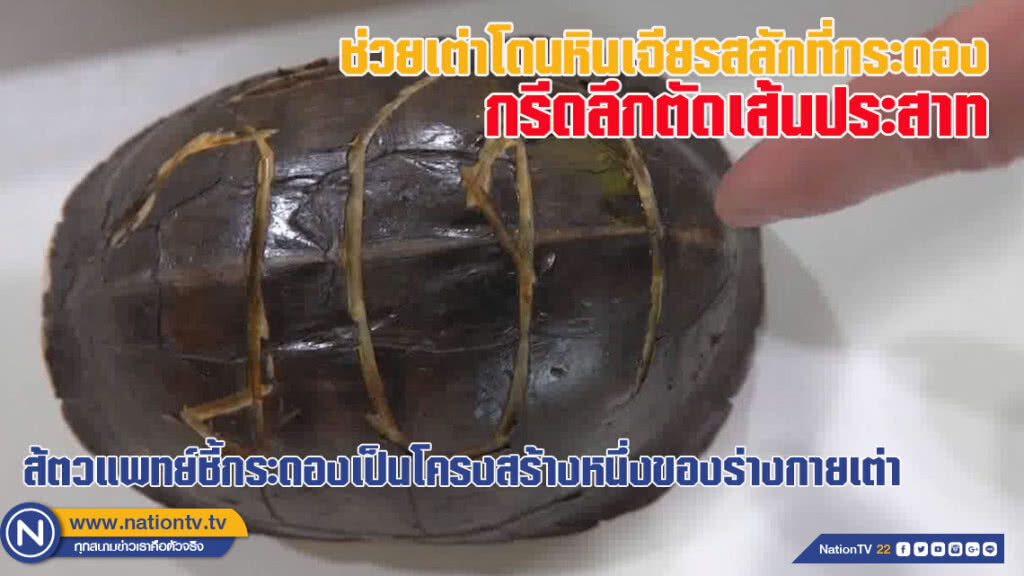ช่วยเต่าโดนหินเจียรสลักที่กระดองกรีดลึกตัดเส้นประสาท (ชมคลิป)