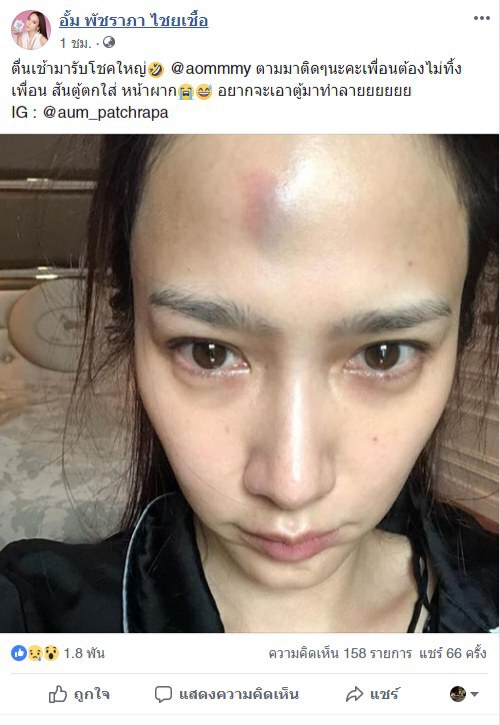 "อั้ม" เจ็บ สันตู้! ตกใส่หน้า