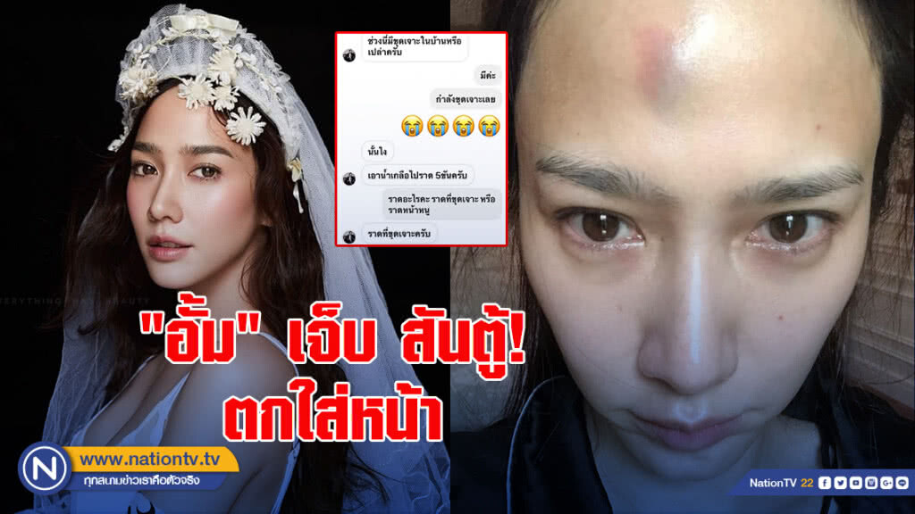 "อั้ม" เจ็บ สันตู้! ตกใส่หน้า "อั้ม" เจ็บ สันตู้! ตกใส่หน้า
