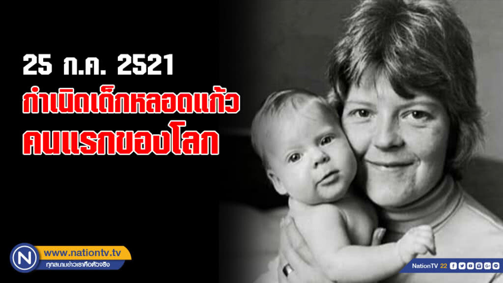25 ก.ค.2521 : กำเนิด "หลุยส์ บราวน์" เด็กหลอดแก้ว คนแรกของโลก