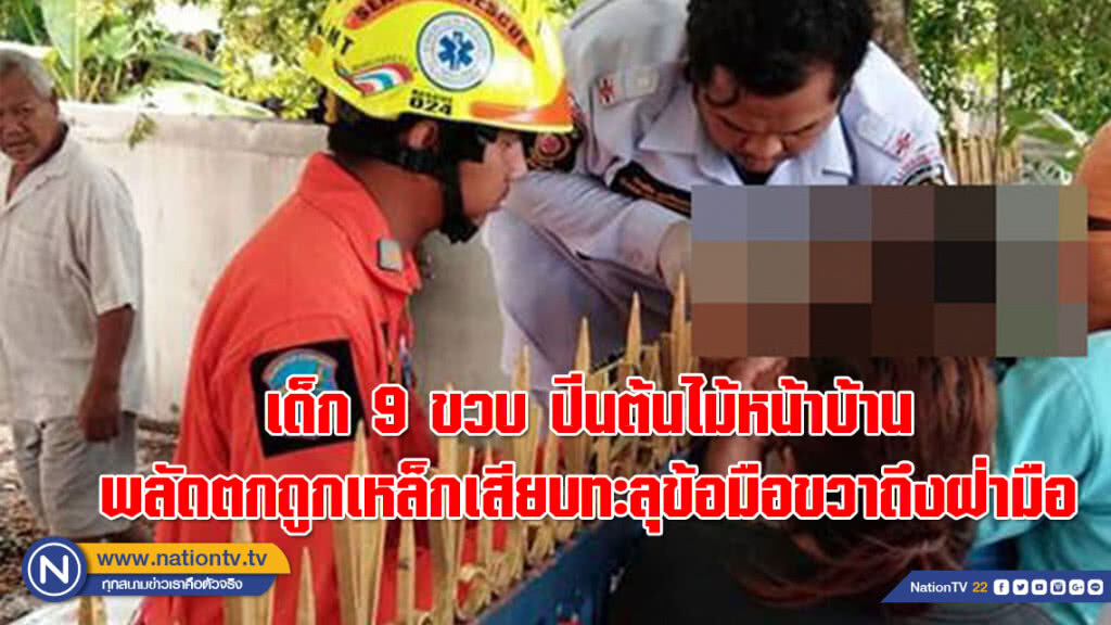 เด็ก 9 ขวบ ปีนต้นไม้หน้าบ้าน พลัดตกถูกเหล็กเสียบทะลุข้อมือขวาถึงฝ่ามือ