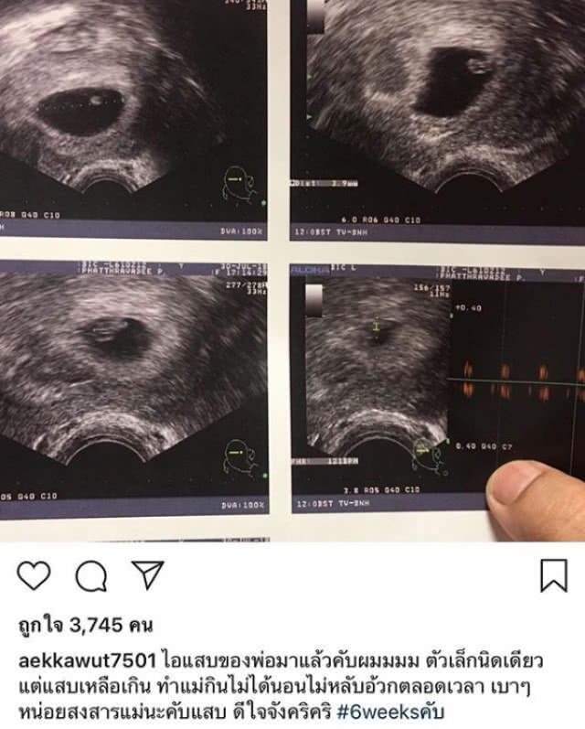 "หนูเล็ก ก่อนบ่าย" มีข่าวดีมาบอก!!! กำลังตั้งครรภ์ลูกคนแรก