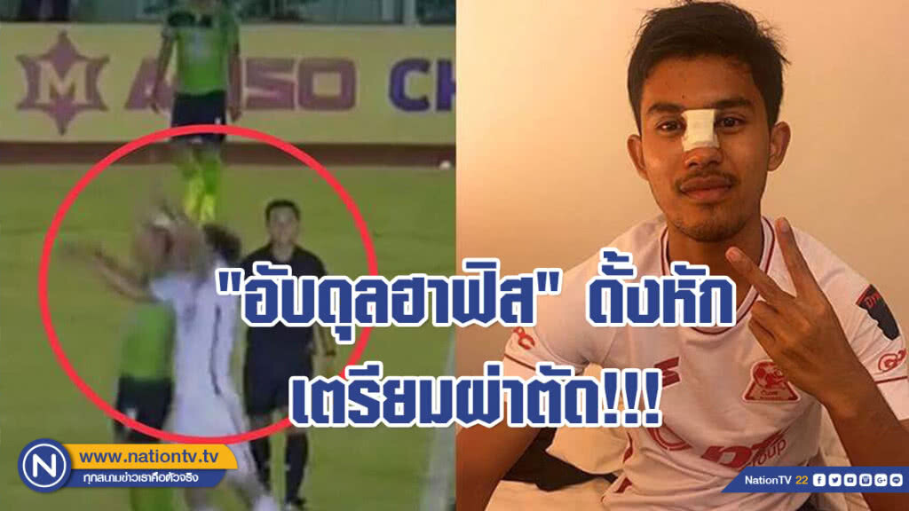 "อับดุลฮาฟิส" ดั้งหักเตรียมผ่าตัด!!! คาดพักอย่างต่ำ 1 เดือน