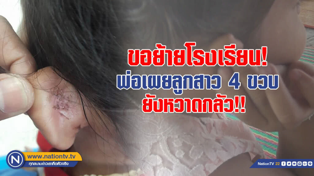 พ่อขอย้ายโรงเรียน! เผยลูกสาว 4 ขวบ ยังหวาดกลัว หลังครูสารภาพบิดหูจริง!!