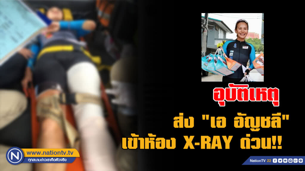 อุบัติเหตุ ส่ง "เอ อัญชลี" เข้าห้อง X-RAY ด่วน!!