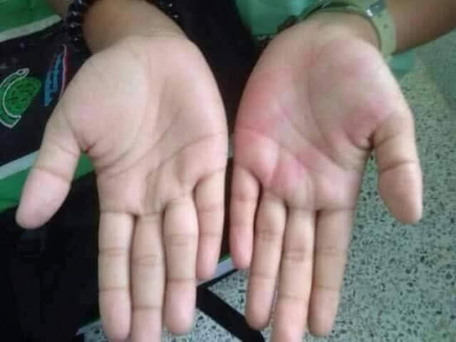 โลกโซเชี่ยลแห่คอมเม้นท์!!! (คลิป)เด็กถูกคุณครูหวดมือเต็มแรง เกินไปไหม???