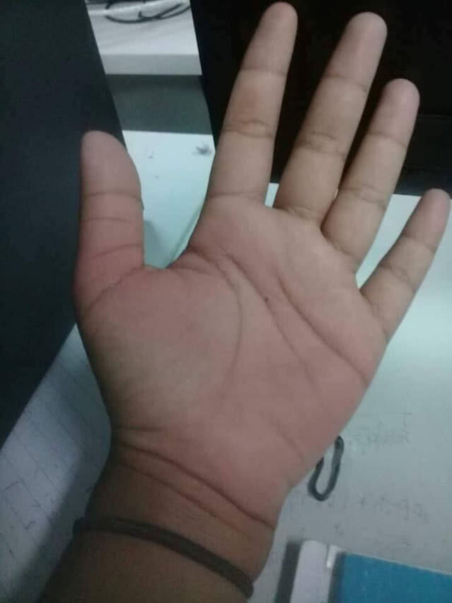 โลกโซเชี่ยลแห่คอมเม้นท์!!! (คลิป)เด็กถูกคุณครูหวดมือเต็มแรง เกินไปไหม???