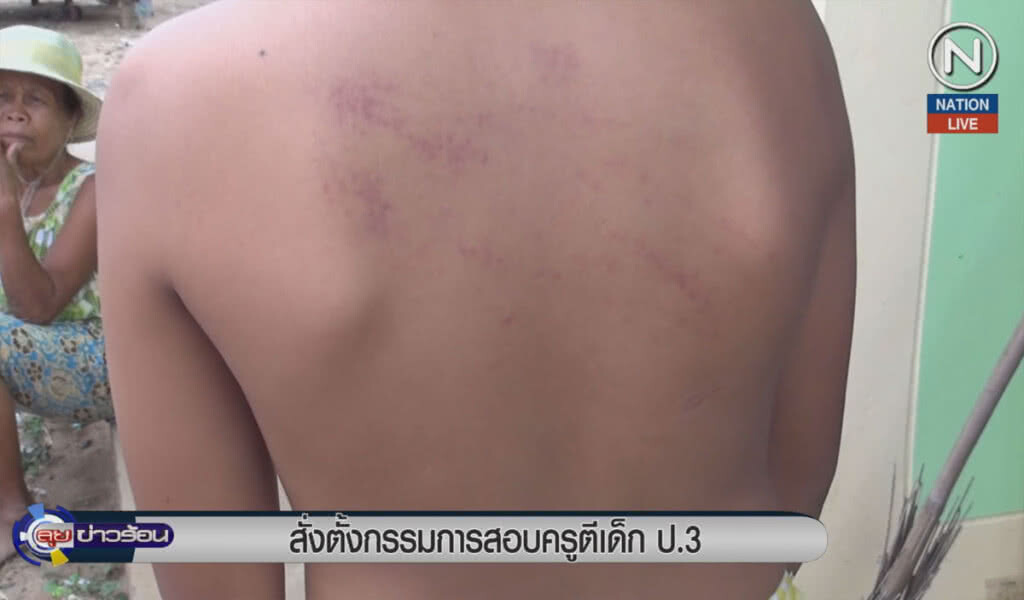 (คลิปข่าว) สั่งตั้งกรรมการสอบครูตีเด็ก ป.3 (คลิปข่าว) สั่งตั้งกรรมการสอบครูตีเด็ก ป.3