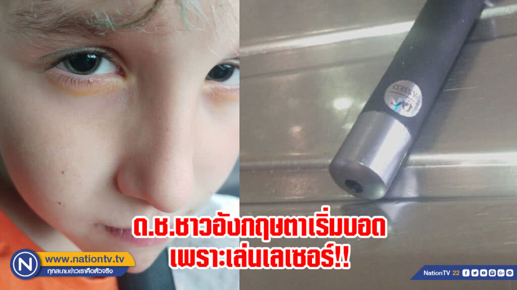 เอาไว้สอนลูกหลาน! เด็กชายอังกฤษตาเริ่มบอดหลังฉายแสงเลเซอร์ใส่ตาแม้แม่ห้ามแล้ว