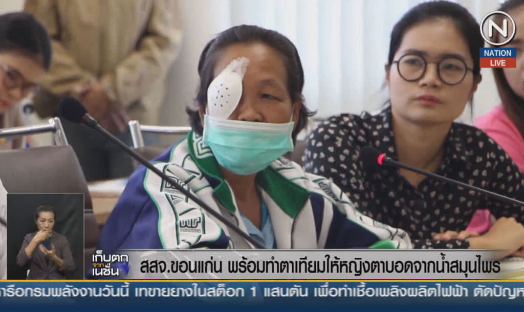 (คลิปข่าว) สสจ.ขอนแก่น พร้อมทำตาเทียมให้หญิงตาบอด จากน้ำสมุนไพร (คลิปข่าว) สสจ.ขอนแก่น พร้อมทำตาเทียมให้หญิงตาบอด จากน้ำสมุนไพร