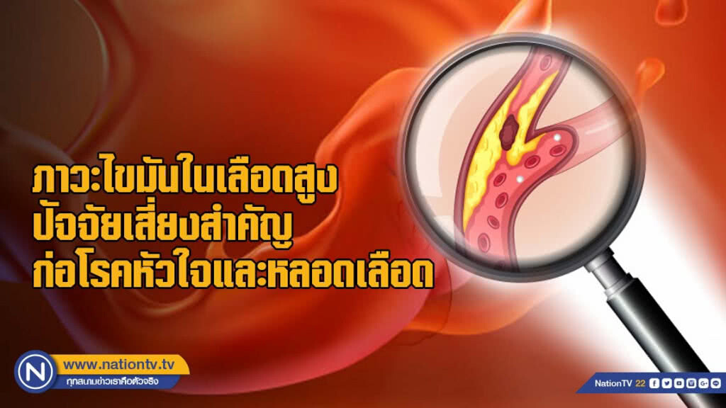 ภาวะไขมันในเลือดสูง ปัจจัยเสี่ยงสำคัญ ก่อโรคหัวใจและหลอดเลือด