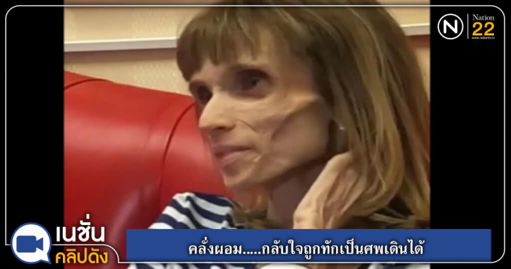 (คลิปข่าว) คลั่งผอม.....กลับใจถูกทักเป็นศพเดินได้ (คลิปข่าว) คลั่งผอม.....กลับใจถูกทักเป็นศพเดินได้