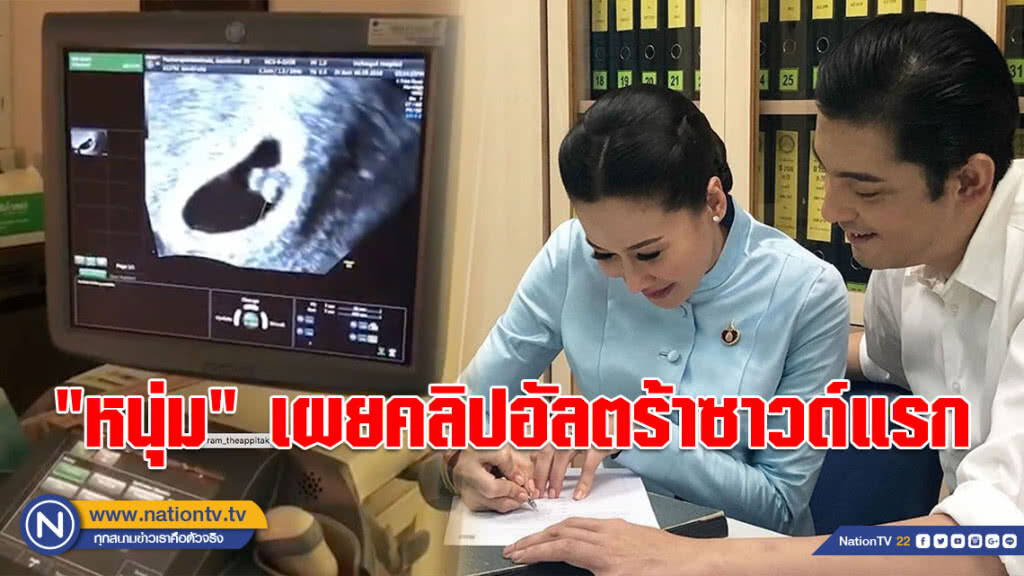 "หนุ่ม" เผยคลิปอัลตร้าซาวด์แรก ของ "ศรรามจูเนียร์" หลังเข้าพิธีวิวาห์