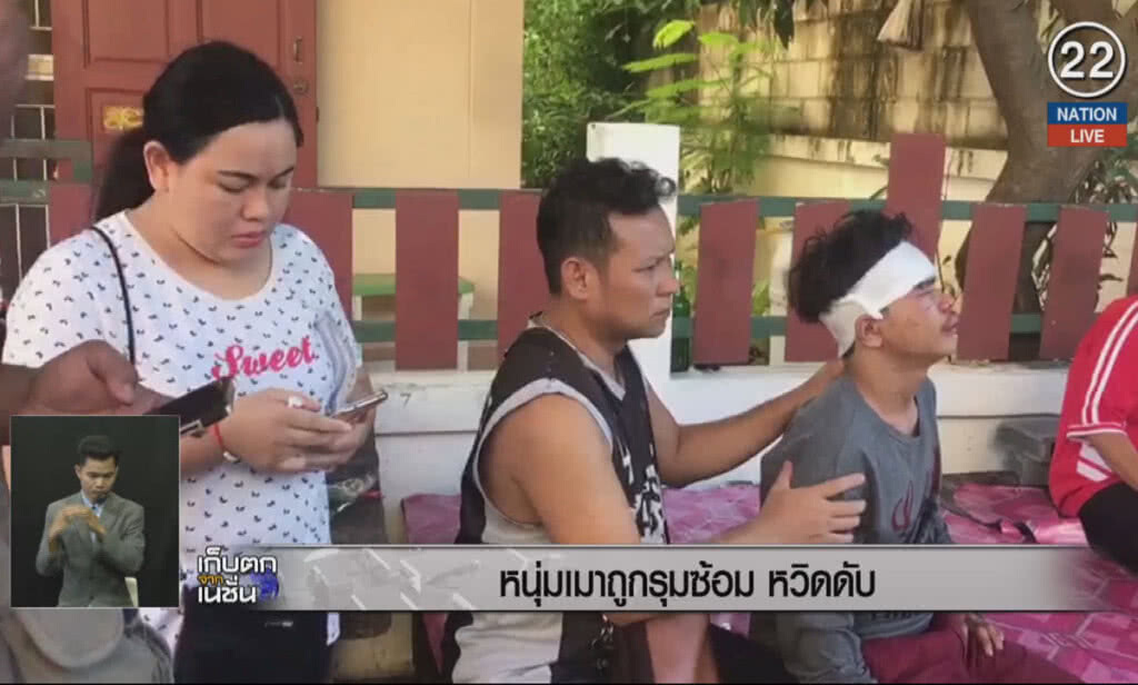 (คลิปข่าว) หนุ่มเมาถูกรุมซ้อมหวิดดับ (คลิปข่าว) หนุ่มเมาถูกรุมซ้อมหวิดดับ