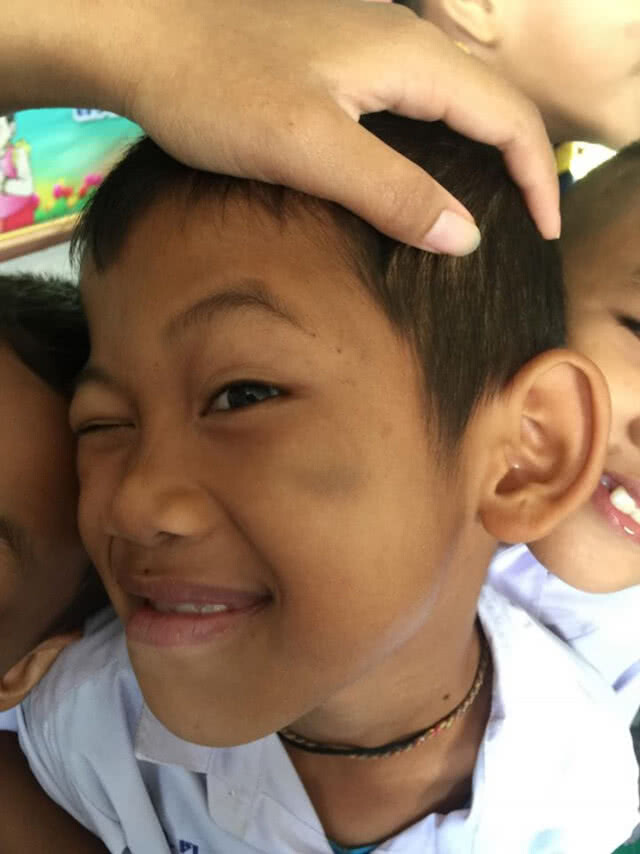 (คลิป) ฟังคำตอบจากเด็กชาย เมื่อครูถามว่า "หน้าไปโดนอะไรมา"