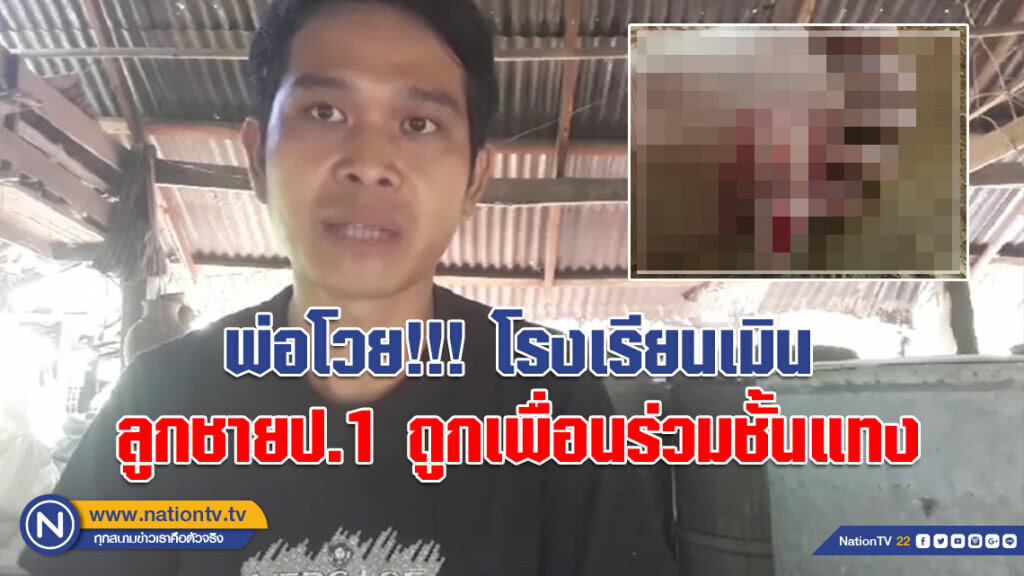 (คลิป) พ่อโวย!!! ครู-ผอ.เมินช่วย หลังลูกชายป.1 ถูกเพื่อนร่วมชั้นแทงเท้าเหวอะ