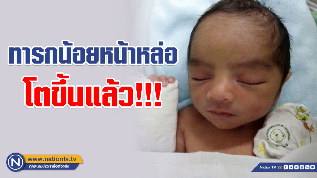 ส่อง!!! ทารกน้อยหน้าหล่อที่เคยโด่งดังบนโลกโซเชียล ตอนนี้จะเป็นยังไงน้า... ส่อง!!! ทารกน้อยหน้าหล่อที่เคยโด่งดังบนโลกโซเชียล ตอนนี้จะเป็นยังไงน้า...