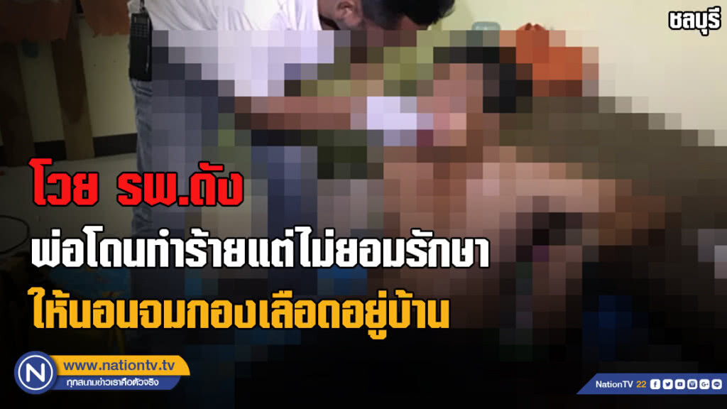 รอเลขประชาชน?!! พ่อโดนตีน่วม รพ.ไม่รักษาปล่อยนอนจมกองเลือดอยู่บ้าน