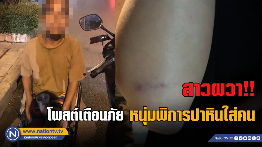 ชายพิการชอบปาหินใส่ผู้หญิง รอดคดีทุกครั้งเพราะเป็น "คนพิการ"
