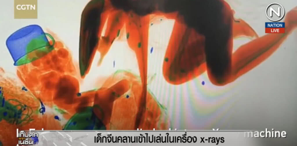 (คลิปข่าว) สุดยอดแห่งความซน เด็กน้อยชาวจีน คลานไปเล่นในเครื่องเอ็กซ์เรย์ (คลิปข่าว) สุดยอดแห่งความซน เด็กน้อยชาวจีน คลานไปเล่นในเครื่องเอ็กซ์เรย์