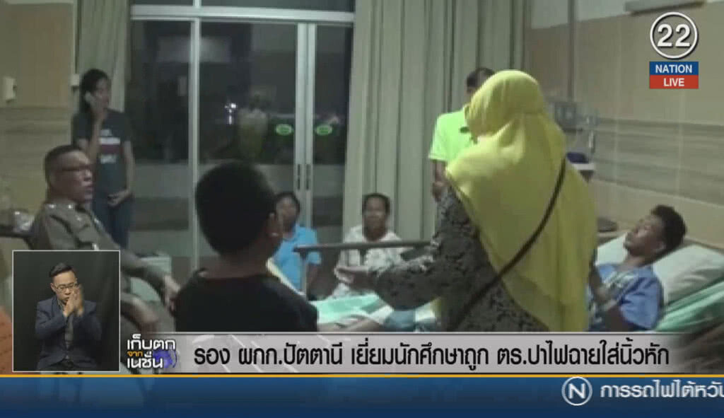 (คลิปข่าว) รอง ผกก.ปัตตานี เยี่ยมนักศึกษา ถูกตำรวจปาไฟฉายใส่นิ้วหัก
